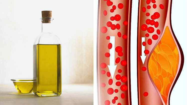 روغن زیتون برای چربی خون بالا