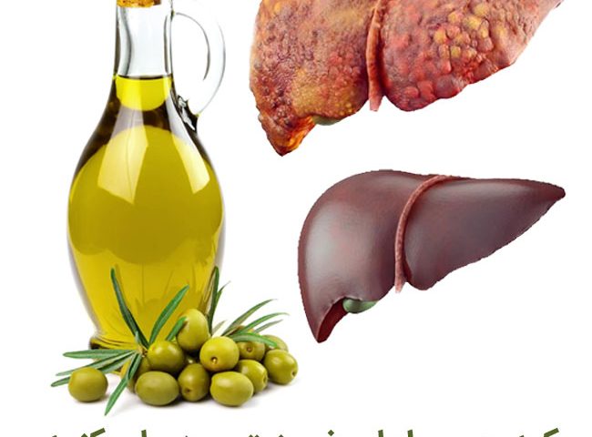 زیتون برای کبد چرب خوب است