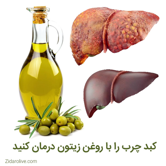 زیتون برای کبد چرب خوب است